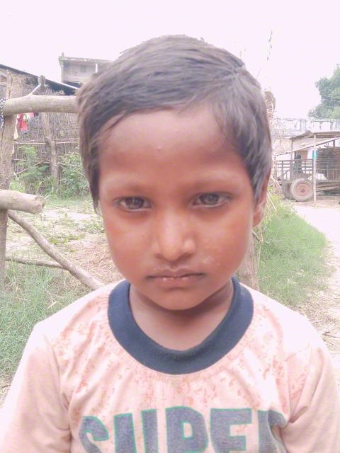 World Vision India